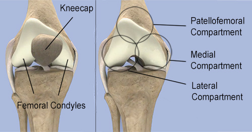 ACL Graft placed too Central on the Tibia